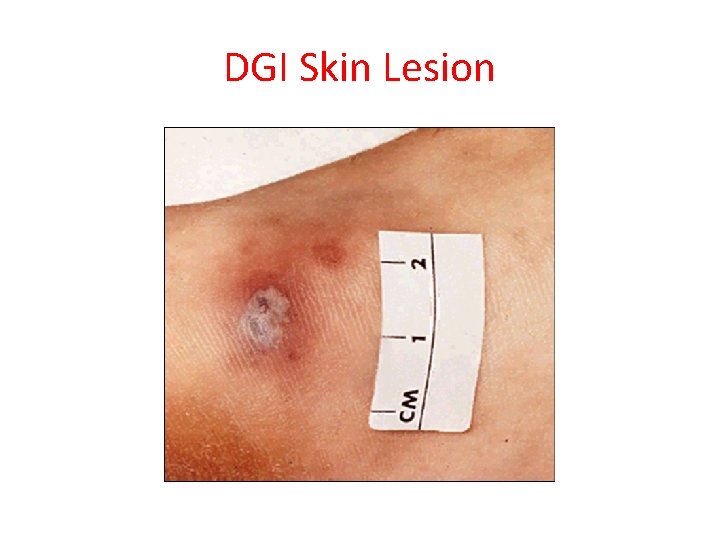 DGI Skin Lesion 