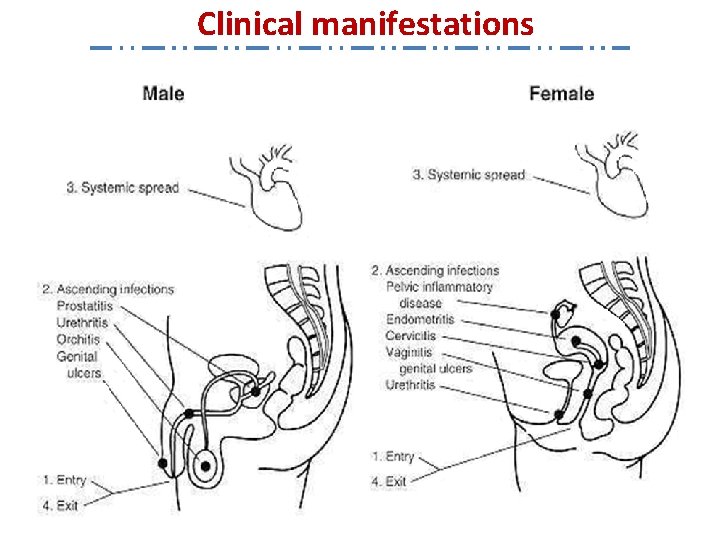 Clinical manifestations 