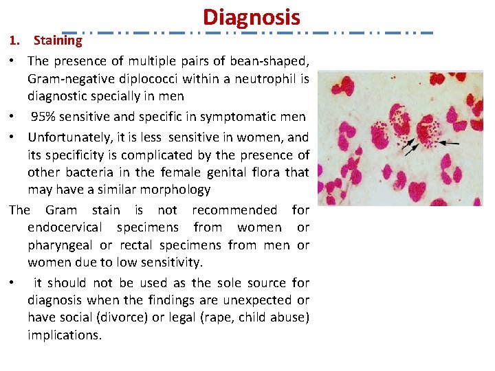 Diagnosis 1. Staining • The presence of multiple pairs of bean-shaped, Gram-negative diplococci within