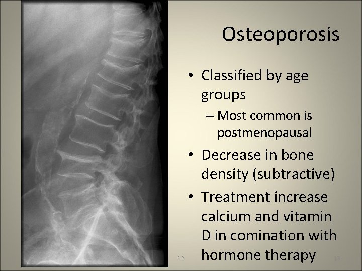 Osteoporosis • Classified by age groups – Most common is postmenopausal 12 • Decrease