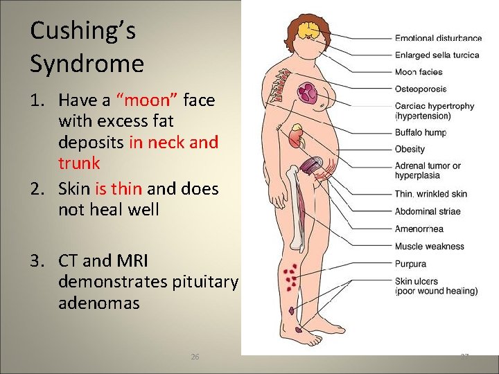Cushing’s Syndrome 1. Have a “moon” face with excess fat deposits in neck and