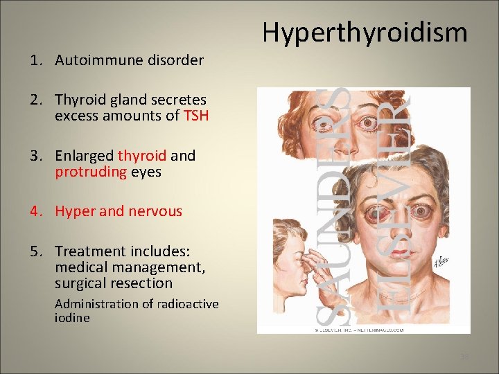 1. Autoimmune disorder Hyperthyroidism 2. Thyroid gland secretes excess amounts of TSH 3. Enlarged