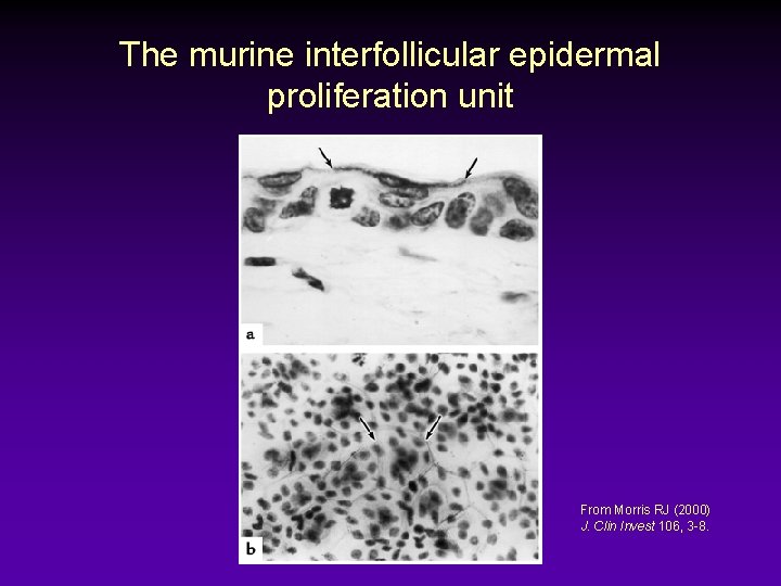 The murine interfollicular epidermal proliferation unit From Morris RJ (2000) J. Clin Invest 106,