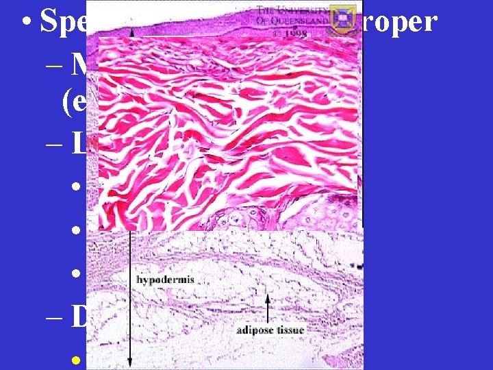  • Specific Types of CT Proper – Mesenchymal CT (embryonic) – Loose CT