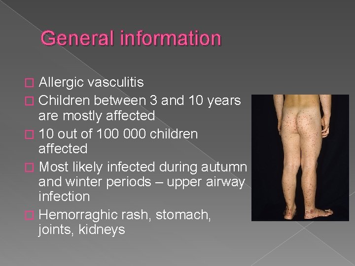 General information Allergic vasculitis � Children between 3 and 10 years are mostly affected