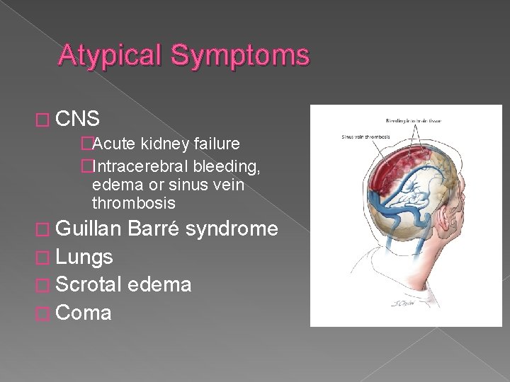 Atypical Symptoms � CNS �Acute kidney failure �Intracerebral bleeding, edema or sinus vein thrombosis