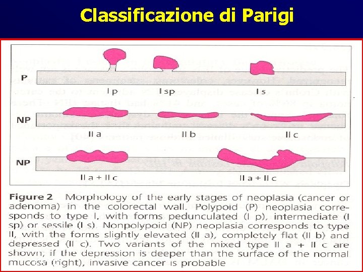 Classificazione di Parigi 6/6/2021 