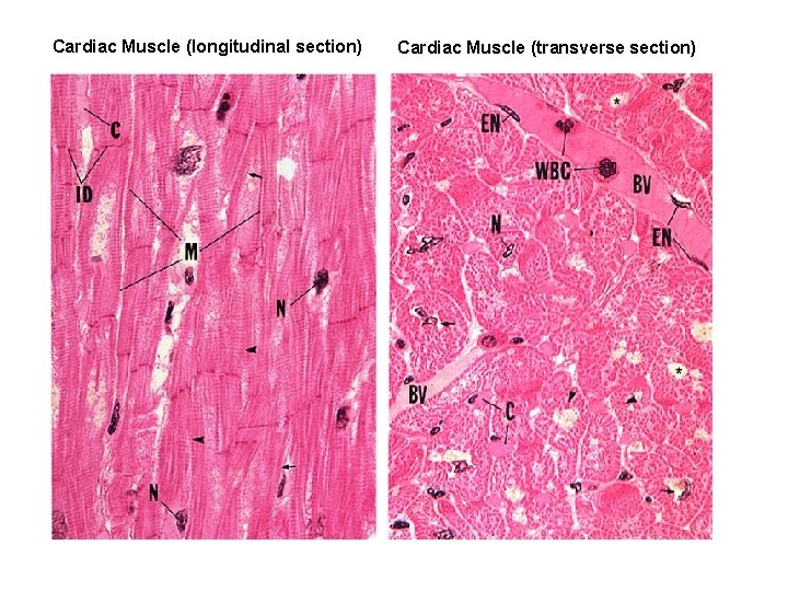 Cardiac Muscle (longitudinal section) Cardiac Muscle (transverse section) 