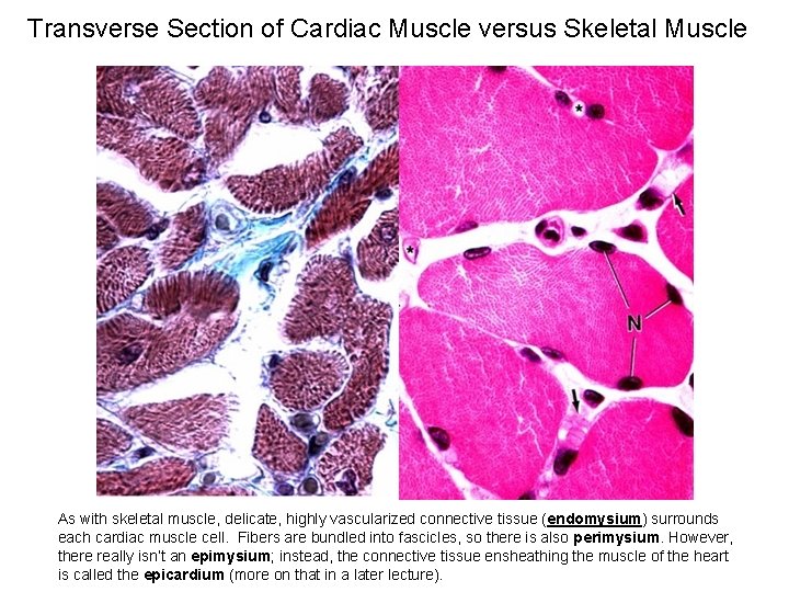 Transverse Section of Cardiac Muscle versus Skeletal Muscle As with skeletal muscle, delicate, highly