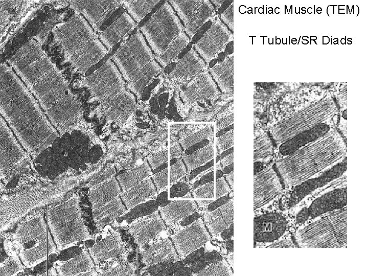 Cardiac Muscle (TEM) T Tubule/SR Diads 