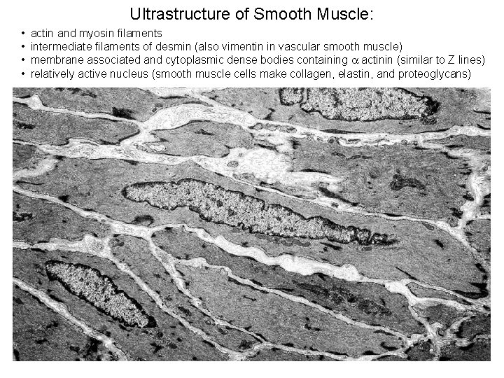 Ultrastructure of Smooth Muscle: • • actin and myosin filaments intermediate filaments of desmin