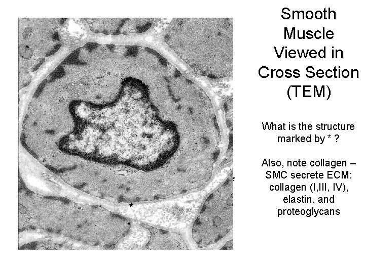 Smooth Muscle Viewed in Cross Section (TEM) What is the structure marked by *