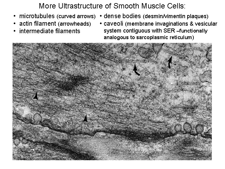 More Ultrastructure of Smooth Muscle Cells: • microtubules (curved arrows) • dense bodies (desmin/vimentin