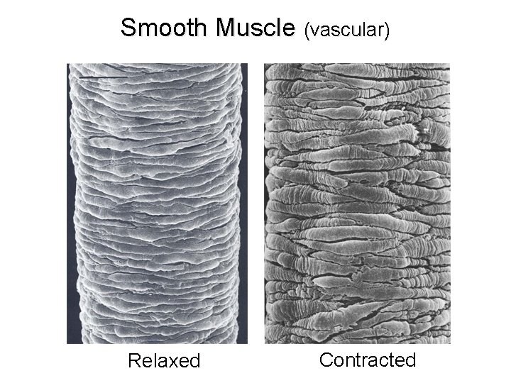 Smooth Muscle (vascular) Relaxed Contracted 