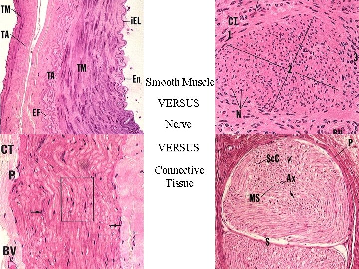 Smooth Muscle VERSUS Nerve VERSUS Connective Tissue 