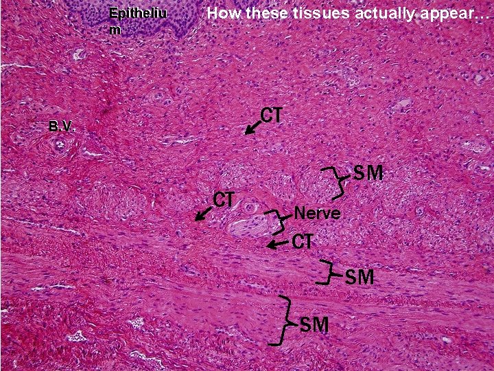 Epitheliu m How these tissues actually appear… CT B. V. . B. V SM