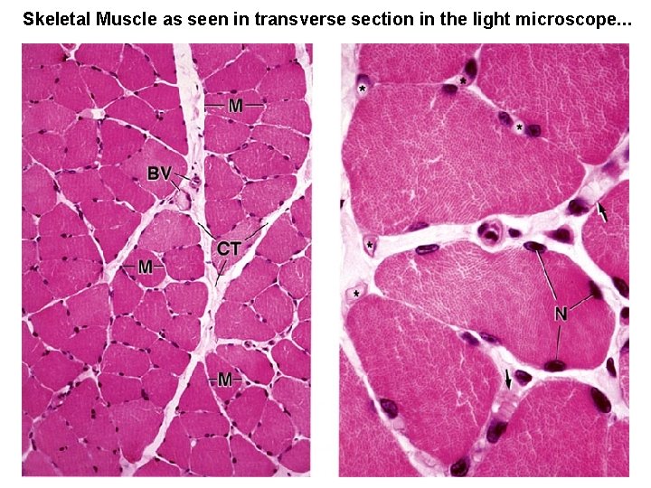 Skeletal Muscle as seen in transverse section in the light microscope. . . 