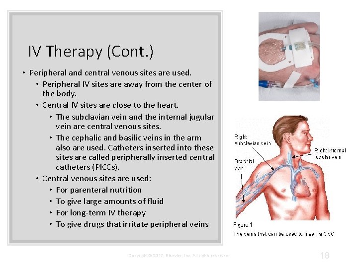 IV Therapy (Cont. ) • Peripheral and central venous sites are used. • Peripheral