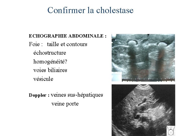 Confirmer la cholestase ECHOGRAPHIE ABDOMINALE : Foie : taille et contours échostructure homogénéité? voies