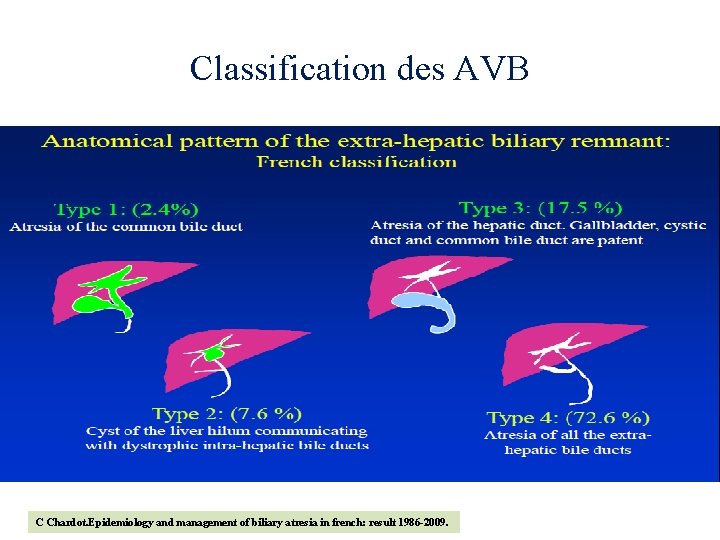 Classification des AVB C Chardot. Epidemiology and management of biliary atresia in french: result