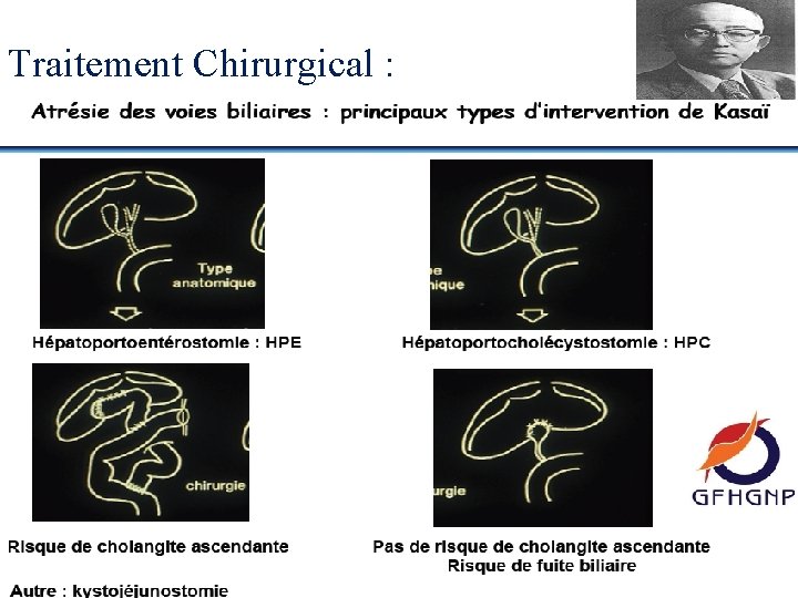 Traitement Chirurgical : 