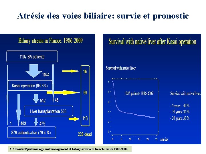 Atrésie des voies biliaire: survie et pronostic C Chardot. Epidemiology and management of biliary