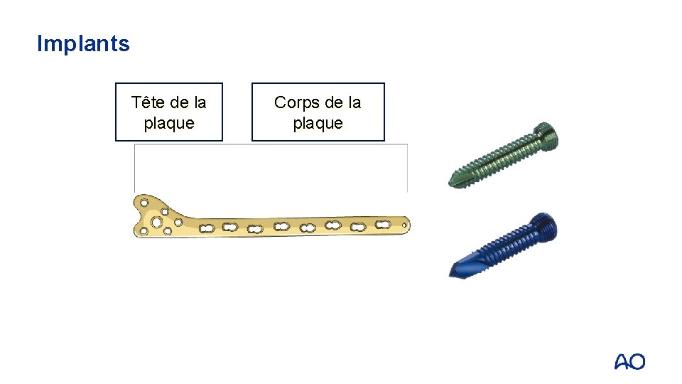 Implants Tête de la plaque Corps de la plaque 