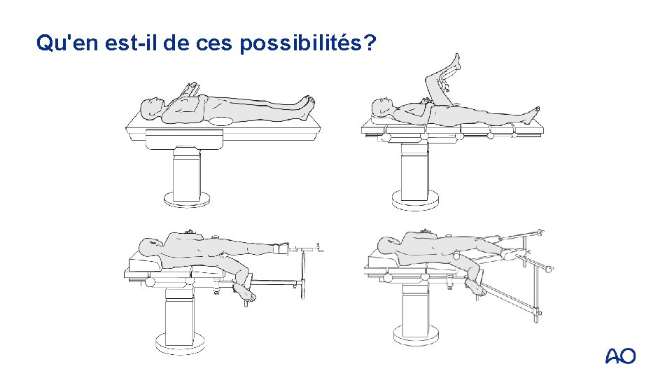 Qu'en est-il de ces possibilités? 