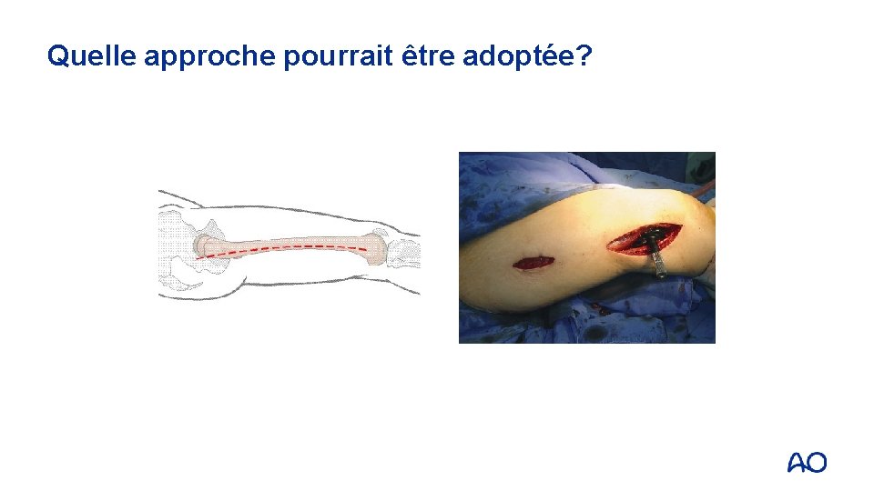 Quelle approche pourrait être adoptée? 