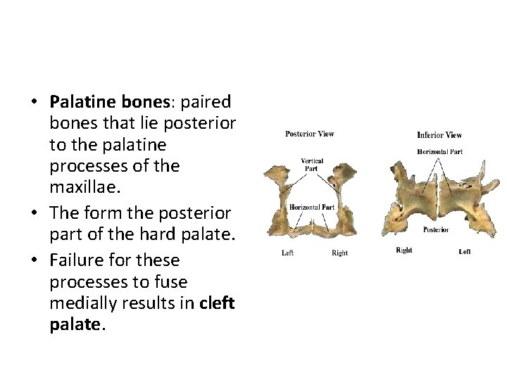  • Palatine bones: paired bones that lie posterior to the palatine processes of