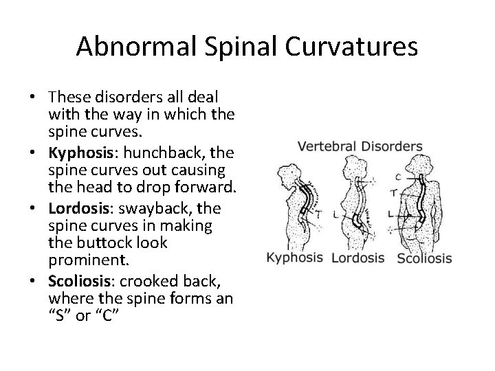 Abnormal Spinal Curvatures • These disorders all deal with the way in which the