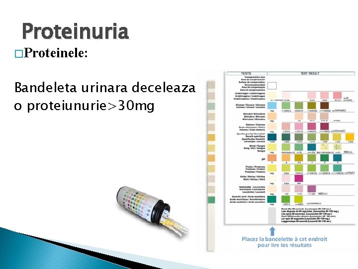 Proteinuria � Proteinele: Bandeleta urinara deceleaza o proteiunurie>30 mg 