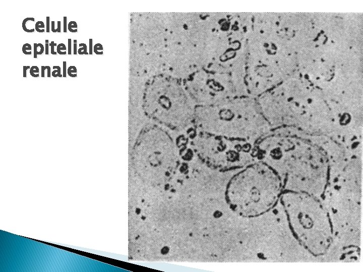 Celule epiteliale renale 