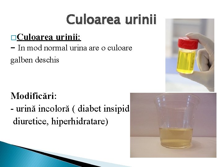 Culoarea urinii �Culoarea urinii: - In mod normal urina are o culoare galben deschis