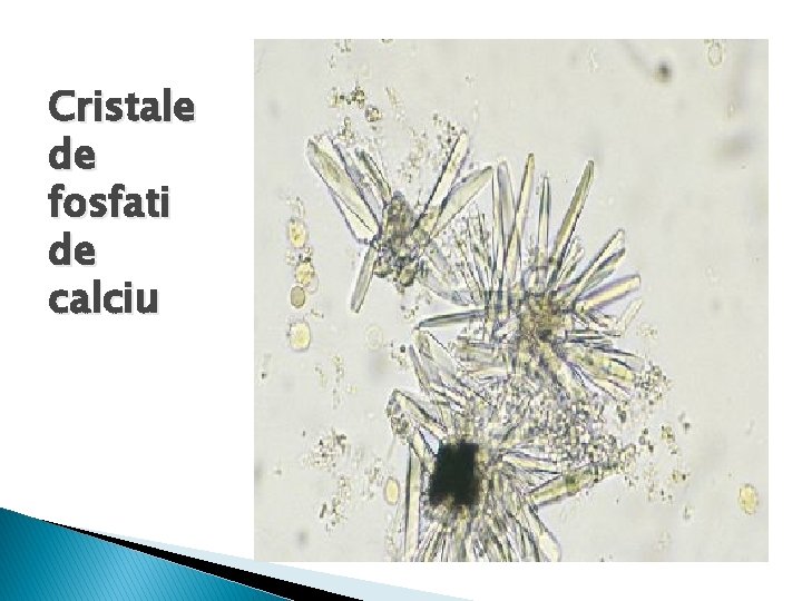 Cristale de fosfati de calciu 