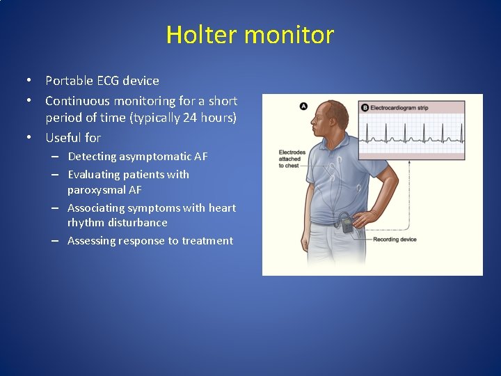 Holter monitor • Portable ECG device • Continuous monitoring for a short period of Holter monitor • Portable ECG device • Continuous monitoring for a short period of