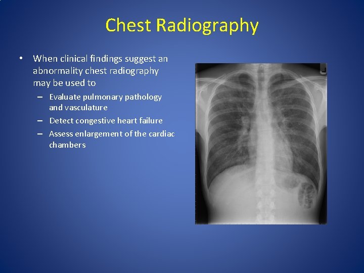 Chest Radiography • When clinical findings suggest an abnormality chest radiography may be used Chest Radiography • When clinical findings suggest an abnormality chest radiography may be used