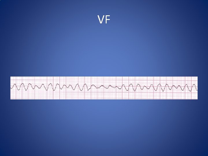 VF VF