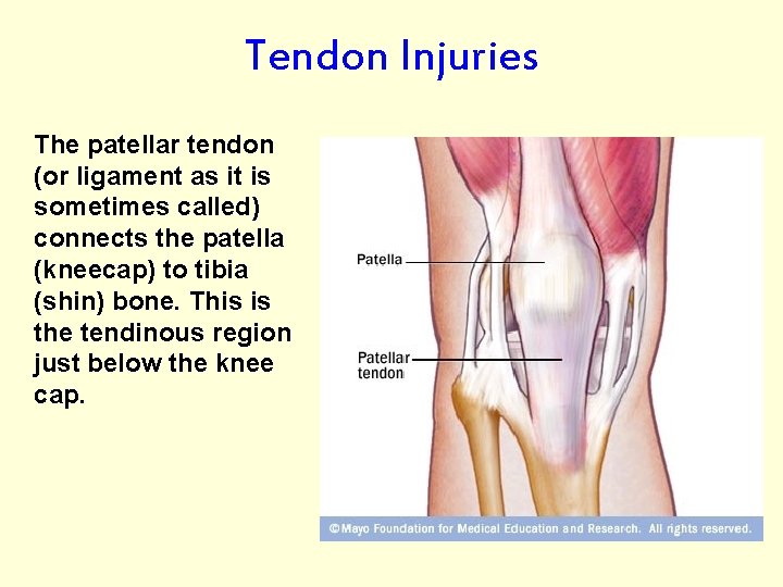 Tendon Injuries The patellar tendon (or ligament as it is sometimes called) connects the