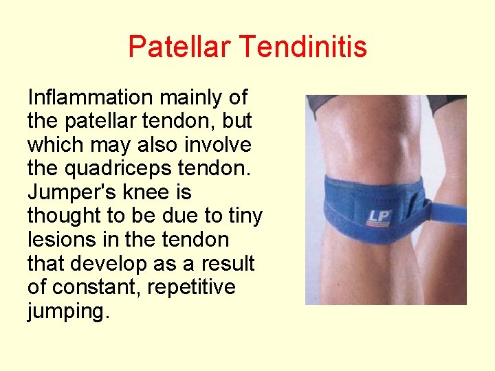 Patellar Tendinitis Inflammation mainly of the patellar tendon, but which may also involve the