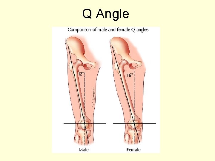 Q Angle 