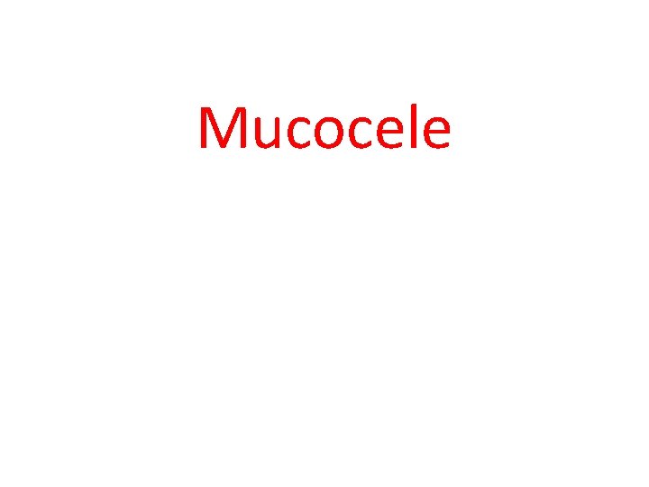 Mucocele 