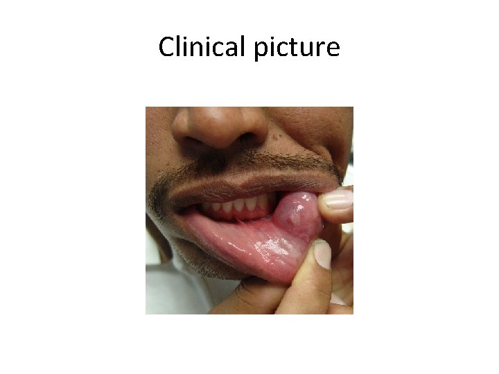 Clinical picture 