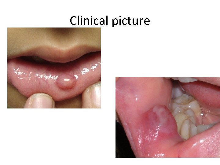 Clinical picture 