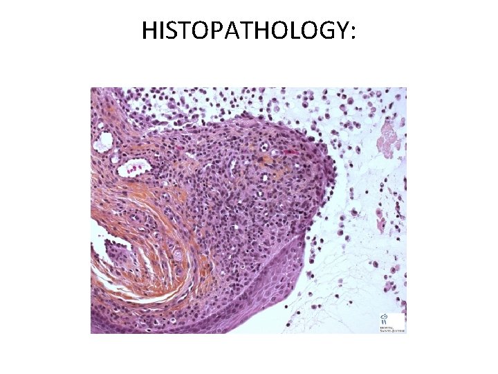 HISTOPATHOLOGY: 