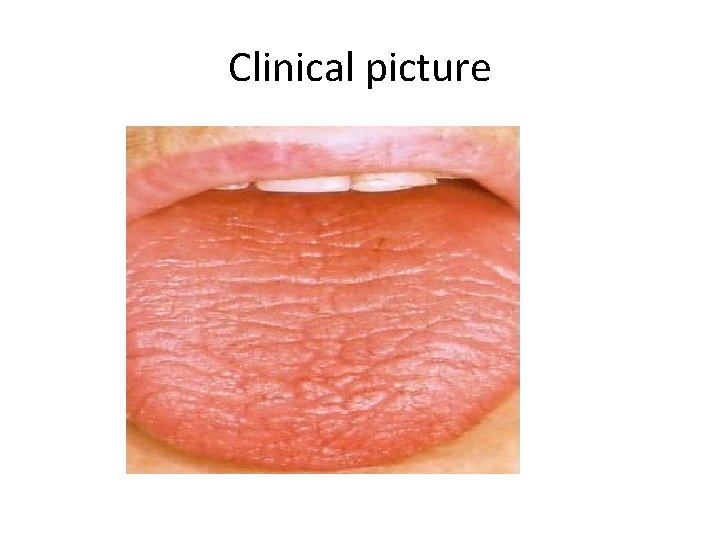 Clinical picture 