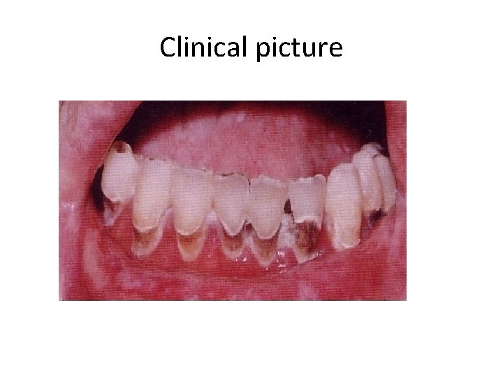 Clinical picture 