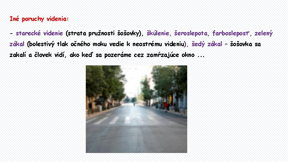 Iné poruchy videnia: - starecké videnie (strata pružnosti šošovky), škúlenie, šeroslepota, farbosleposť, zelený zákal