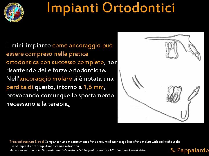 Impianti Ortodontici Il mini-impianto come ancoraggio può essere compreso nella pratica ortodontica con successo