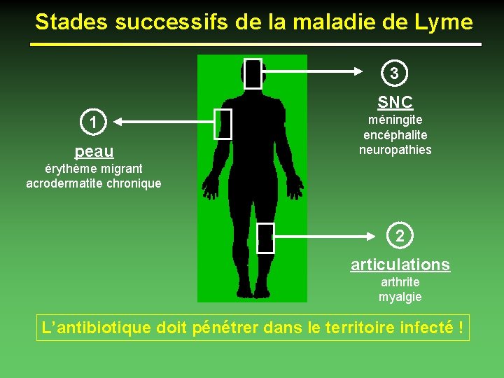 Stades successifs de la maladie de Lyme 3 SNC 1 peau méningite encéphalite neuropathies